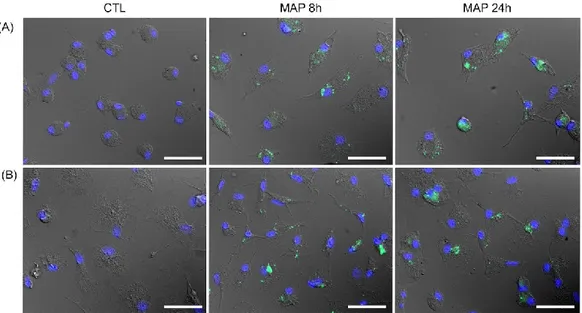 Table 2.S2 : Macrophages MAP infection percentage at each time point of the  in vitro infection mesured using the fluorescence microscopy picture 