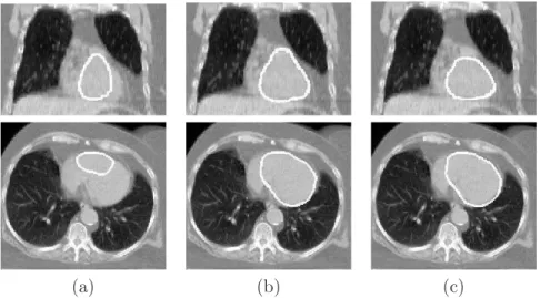 Figure 3.26: Coronal and axial views of some results of heart segmentation. The contours, superimposed on