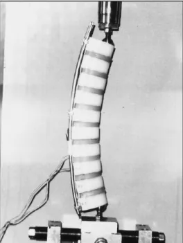 Figure 44: Exemple de substitut de segment vertébral pour l'étude de l'influence de la cyphose  sur les « performances » d'un implant postérieur [Orchowski et al