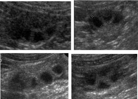 Figure  2:  Different  aspects  of  pre-ovulatory  follicles:  a.  usual  round  or  slightly  triangular aspect