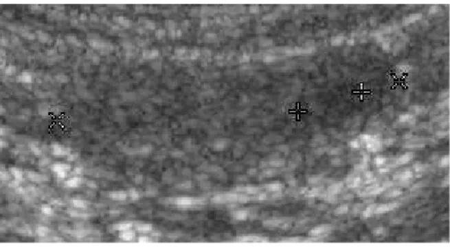 Figure 3: Inactive left ovary in the pro-estrous period.  