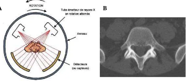 Figure 11 : (A) Principe du CT-Scan (d’après un schéma de Bernard Nicolas -  