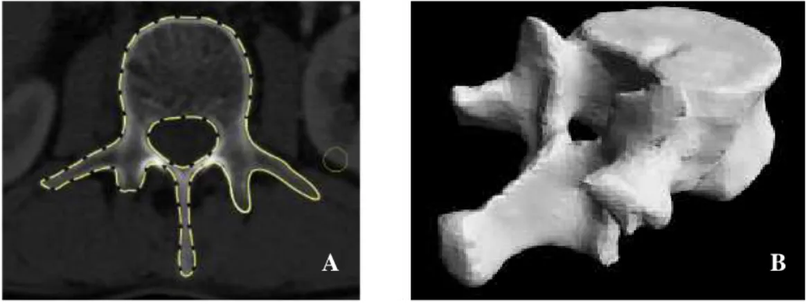 Figure 13 : Segmentation manuelle d’une vertèbre à partir d’une coupe CT-scan (A) et reconstruction 3D  par l’algorithme des « marching cubes » (B) (logiciel SliceOmatic (TomoVision, Montréal, Canada)) 
