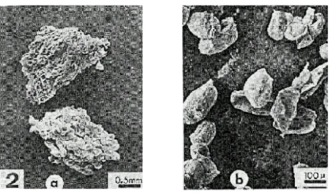 Figure 9 : Observation microscopique de purées de pommes. A gauche, une purée aux particules grossières