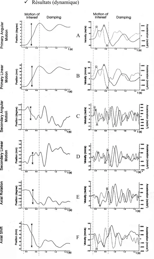 Figure 35 : résultats en L4 pour une sollicitation de flexion-extension pour une unité L4-L5 graphes A : rotation principale (flexion), vitesse (o) et accélération (    ) angulaire graphes B : translation principale (antéro-postérieure), vitesse et accélér