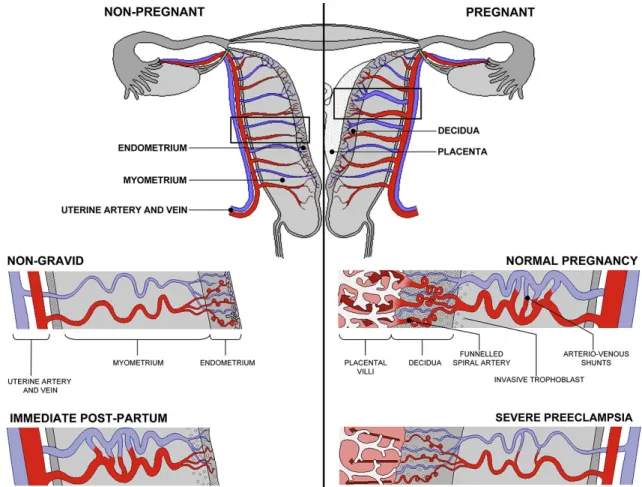 Figure 1.12. Remodeling of the maternal spiral arteries in pregnancy. Note the dilation and the funneled
