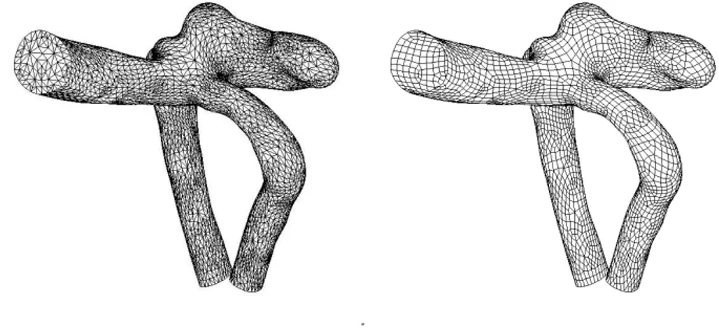 Figure 9: Fluid and solid meshes of a cerebral aneurysm: 69754 tetrahedrons and 5534 quadrilaterals.