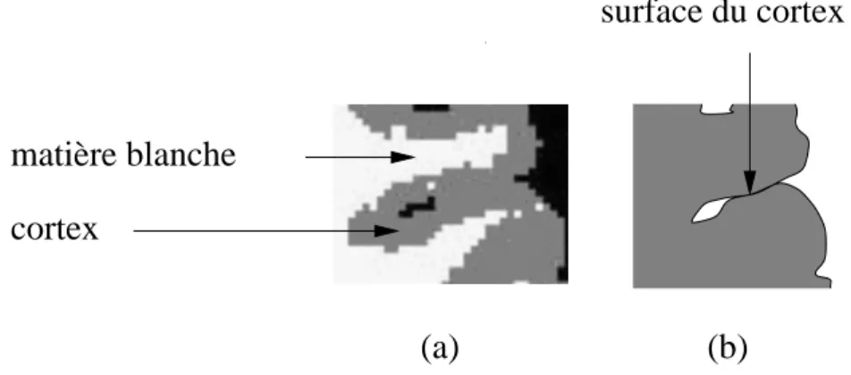 Fig. 2.3 { Le volume partiel des images IRM peut masquer la surface corti- corti-cale