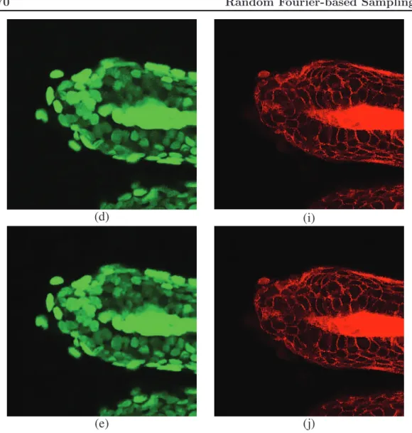 Figure 2.10: Green and red channels; ﬂuorescence microscopy image of hair follicle. (a)(f) Original noisy image