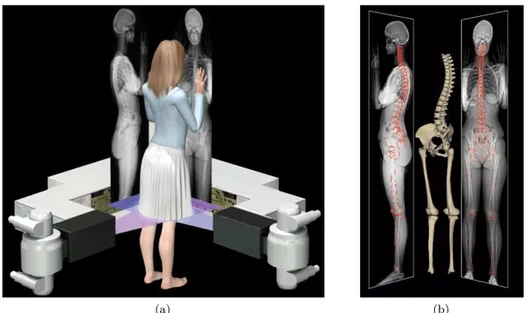 Figure 1.1: EOS: (a) acquisition principle; (b) 3D model from the frontal and lateral view acquisitions.