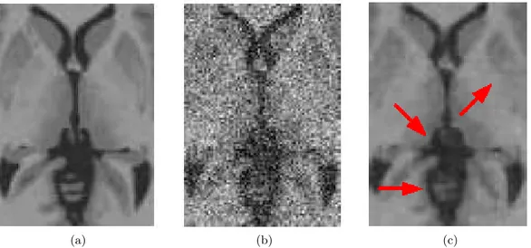 Figure 2.3: Application of NL-means filter to MRI brain images: (a) Input image; (b) Noisy image adding AWGN noise; (c) Image (b) restored by using the NL-means filter