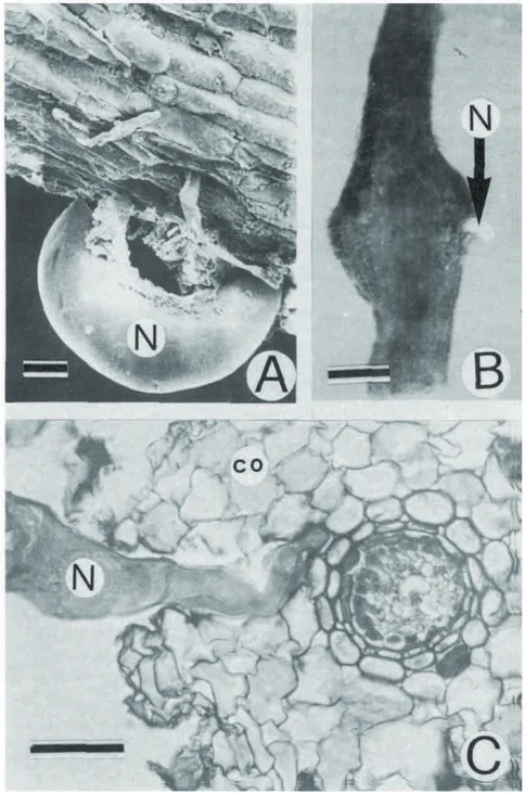Figure  2  (A)  Racine  de  bananier  infectée  par  Rotylenchulus  reniformis  seul  ou  (B)  en  association  avec 