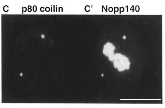 Figure  II-5:  Double  immunofluorescence  indirecte  sur  cellules  BRL,  observée  en  microscopie  confocale