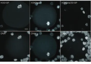 Figure 3. H3S10P / H3K9me3 / H3K9me3S10P detection in cumulus cells. Metaphase II  embryos  with  remaining  cumulus  cells  were  processed  to  detect  H3S10P  /  H3K9me3  /  H3K9me3S10P