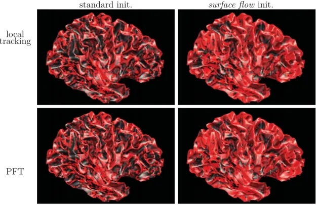 Figure 3.7 – Coverage of endpoints of streamlines along the WM-GM interface (red if there is an intersection in the 1mm radius, black otherwise) : a) surface ﬂow with PFT, b) PFT, c) local tractography