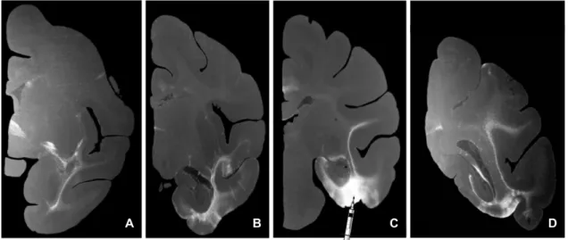 figure 1.15 – Multiples tranches montrant la propagation d’un traceur axonal jointe à une imagerie par autoradiographie [ Meyer et Meyer , 1973 ] provenant d’un cerveau de singe rhésus
