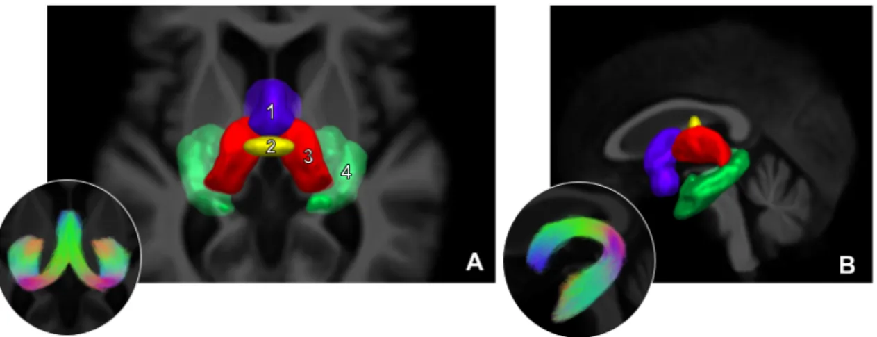 figure 1.17 – Vue axiale (A) et vue sagittale (B) des régions d’intérêt utilisées pour la segmentation manuelle du fornix, faisceau commissural inter-connectant les  hippo-campes liés à différents processus de la mémoire