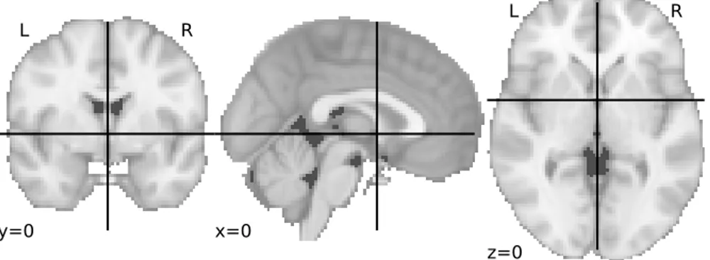 Figure 2.1: ICBM 152 template. This anatomical image was created at the MNI by coregistering and averaging brain scans of 152 adults