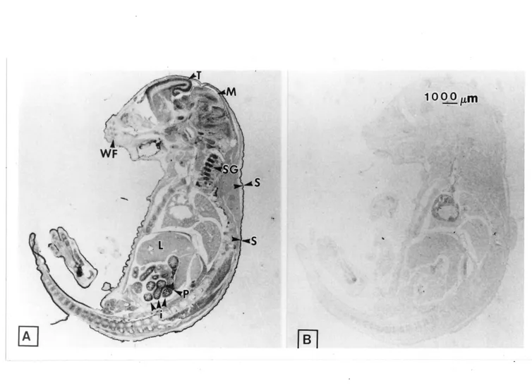 Figure 6. Localisation de Fexpression de l?ARNm de ZPK dans un embryon de souris de 17.5 jours
