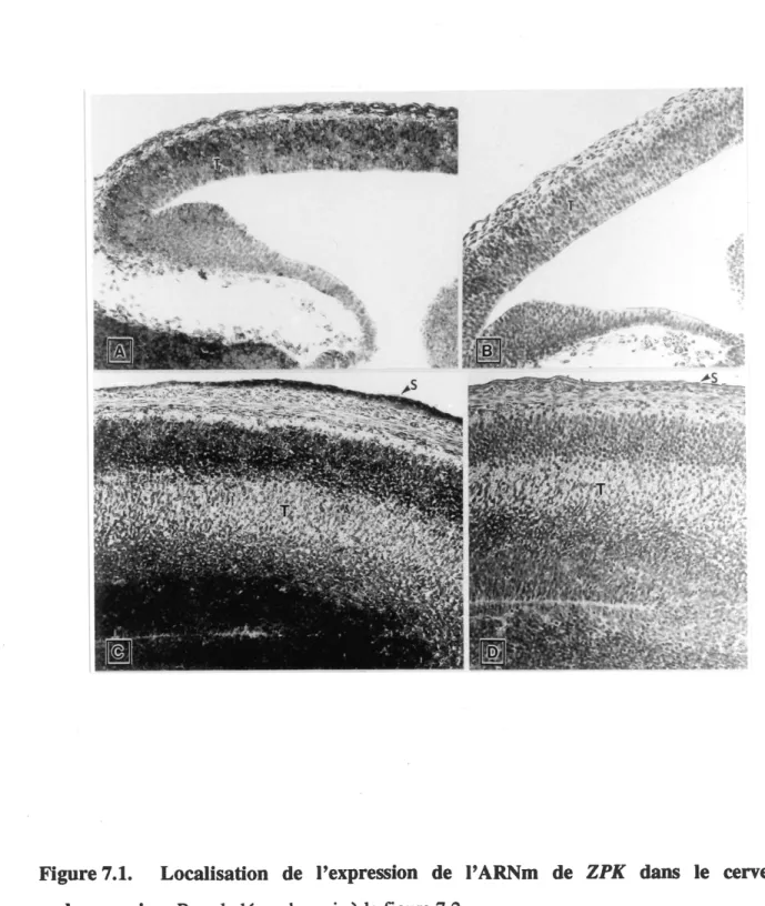 Figure 7.1. Localisation de Pexpression de FARNm de ZPK dans Ie cerveau