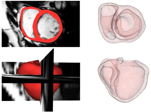 Figure 2.1: Segmented heart with the two ventricles and the four valves, generated from 3D MRI using Cardioviz3D.