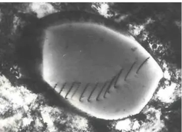 Fig. 1.1  Les disloations dans l'aier inoxydable.