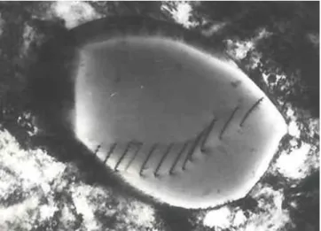 Fig. 2.1  Disloations in stainless steel.