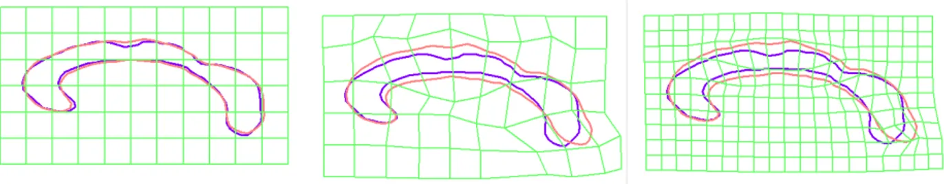Fig. 2.6: Example of Free Form Deformations. (middle) deformations using a 6×10. (right) grid refinement with the same transformation and a 11 × 20 grid.