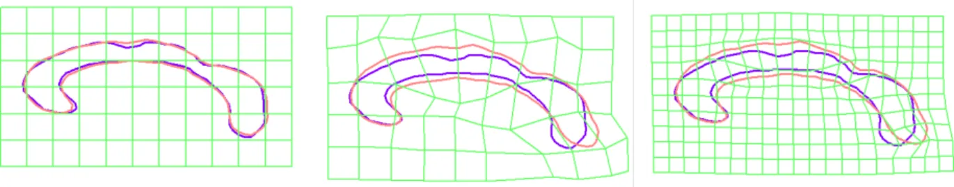 Fig. 2.6: Example of Free Form Deformations. (middle) deformations using a 6×10. (right) grid refinement with the same transformation and a 11 × 20 grid.