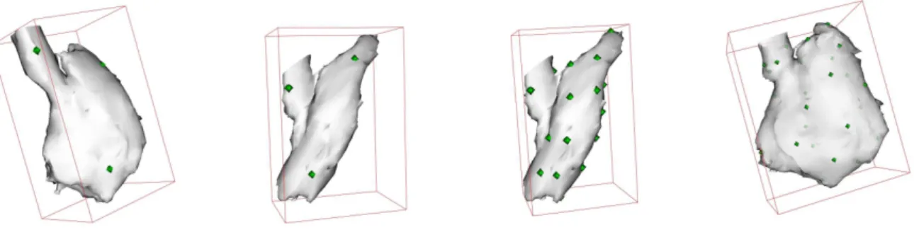 Fig. 2.7: Example of TPS Transformation of the right ventricle. From left to right: initial model with 4 control points; 4-points 3D TPS transform (equivalent to an affine transformation); Refinement of the transformation with 25 control points; TPS transf