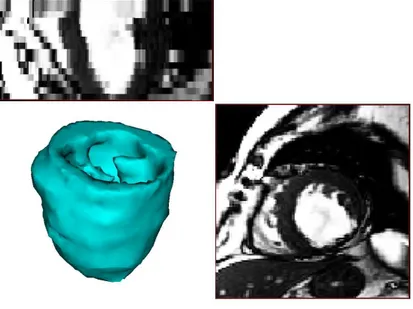 Fig. 2.10: Representation of the manually segmented left ventricle from MRI data