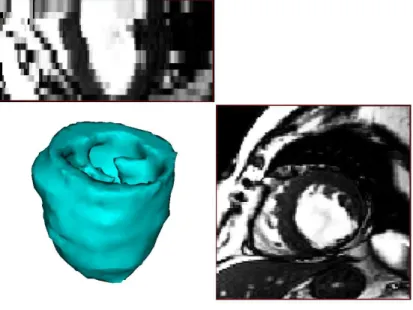Fig. 2.10: Representation of the manually segmented left ventricle from MRI data