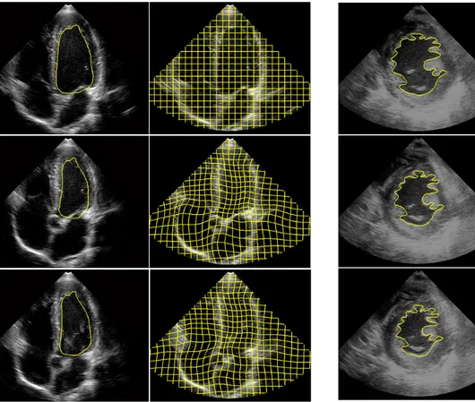 Fig. 4. Propagation of a segmentation of the left ventricle’s endo- endo-cardium in a short-axis view sequence.