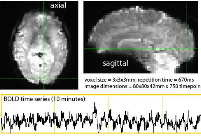 Figure  1.03  -  High  resolution  BOLD  image .  The  time  series  (bottom)  represents  the  activity  within a single voxel in visual cortex over 10 minutes