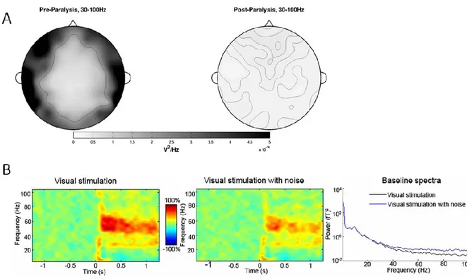 Figure 1.11 – Muscular contamination of high frequency EEG . A) Scalp topography pre and  post paralysis of neck and face muscles illustrating strong contribution of EMG to spectral power  in  scalp  electrodes  during  eyes-closed  task