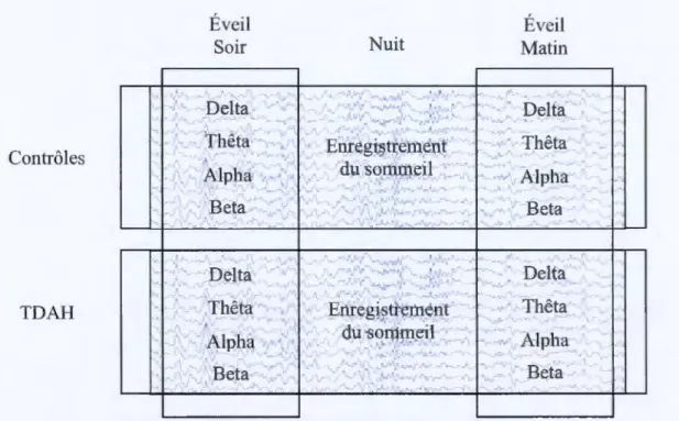 Figure 3.1 Représentation graphique des  trois moments d'enregistrement de l'ÉEG (avant,  pendant et après  la nuit) pour chacun des groupes (TDAH et contrôle)