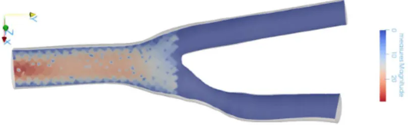 Figure 9: Synthetic CFI for the case of a blockage. Note that the image does not capture the ﬂow after the bifurcation.