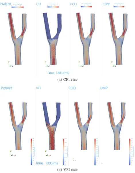 Figure 13: Reconstruction example for blockage case. From left to right, we see the target, the ideal image, the reconstruction with POD and the one with OMP.