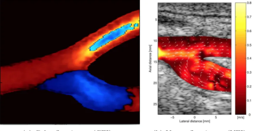 Figure 3: Velocity image of the common carotid bifurcation.