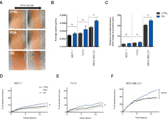 Figure 3.2. Oleic acid  stimulates scratch  wound  closure  in  several  breast cancer cell  lines