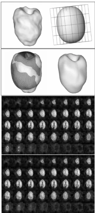 Figure 1: A : From the superellipsoid to the nal