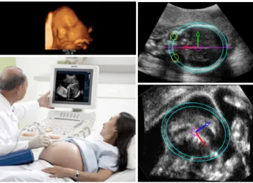 Fig. 1. A near real time alignment of the fetal head during screening examinations to help navigate through the brain