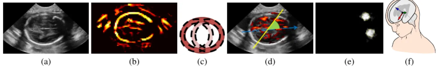 Fig. 2. Workflow: (a) original image; (b) response P of a plate detector for the head detection; (c) approximation of the spheroidal shell by spherical shells for the head detection; (d) weigthed Hough transform on the response of a plate detector to detec