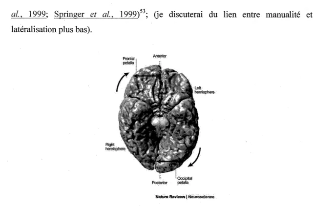 Figure 2.1  Représentation  tridimensionnelle  d'un  cerveau  humain  obtenue  par  résonance  magnétique  illustrant une  asymétrie  cérébrale