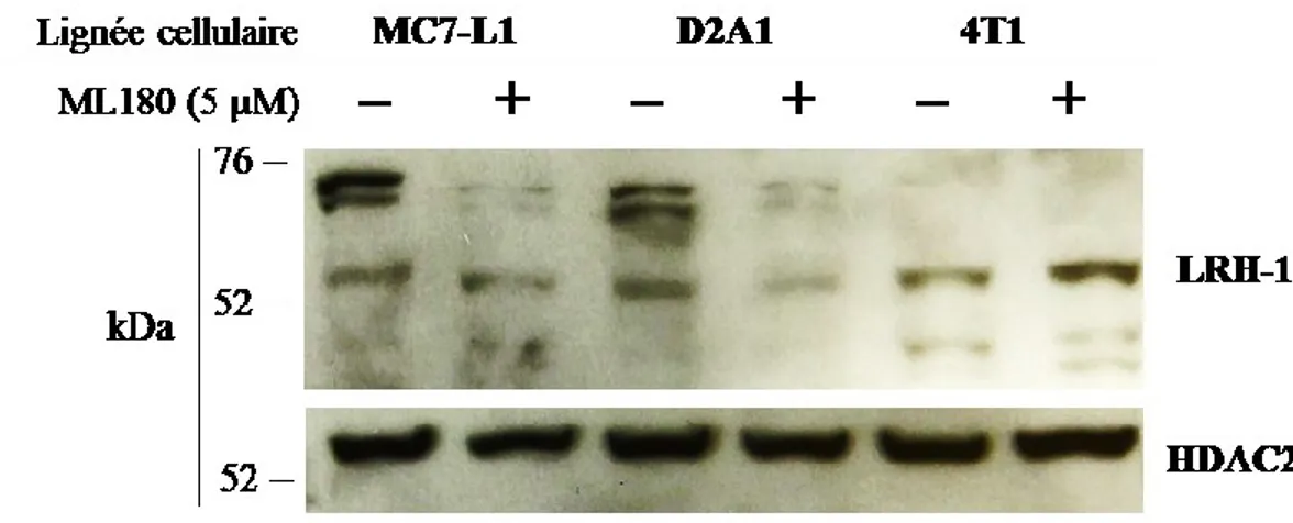 Figure 7 : Immunobuvardage de LRH-1 lors de traitements au ML180.  
