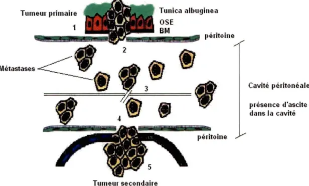 Figure 3 : Schématisation de la cascade métastatique au niveau du cancer ovarien 