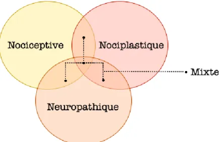 Figure 3. Le modèle de stratification basé sur les mécanismes de douleur et la douleur 