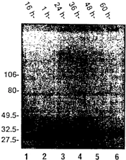 Fig. 6. Time course of deglycosylation of photolabeled AT? receptors from human myometrium