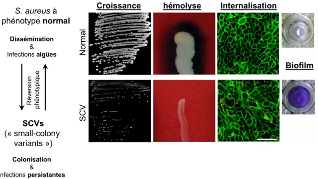 Figure modifiée de (Mitchell et al., 2011, 2012)   Figure 1. Différences entre les phénotypes SCV et prototypes de S