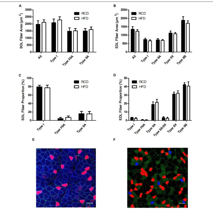 FIGURE 2 | Cross-sectional areas of different fiber types in the SOL (A) and EDL (B) muscles of young rats submitted to HFD or RCD for 14 days